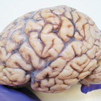 The Not-So Incredible Shrinking Brain